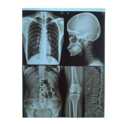 Medical X-ray Blue Film Inkjet