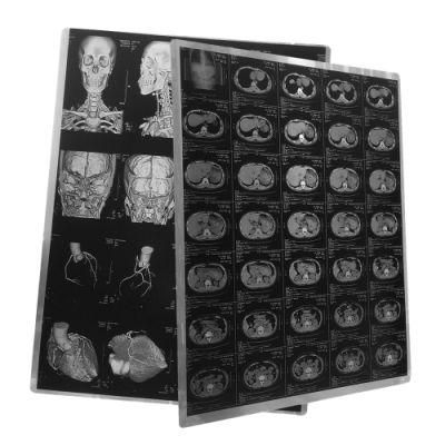 Aesthetic and Diagnostic Medical Laser Imaging Film