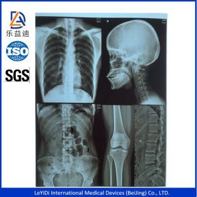 8*10, 10*12, 13*17 and 14*17 Size Medical Inkjet Blue Film
