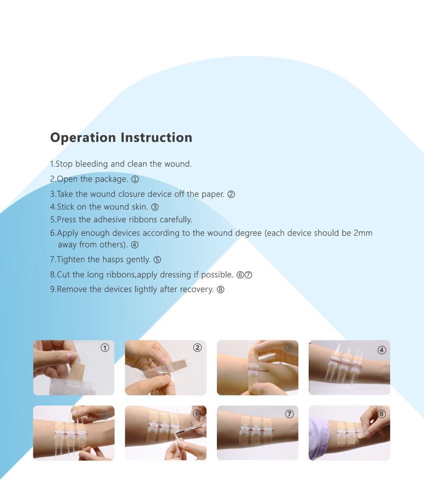 Adhesive Wound Closure Steri Strip Skin Wound Closure