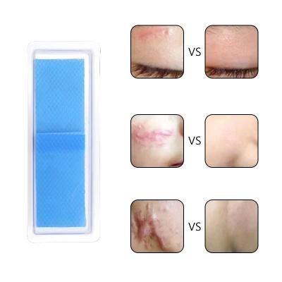Hot Selling Advanced Skincare Long Silicone Scar Sheets