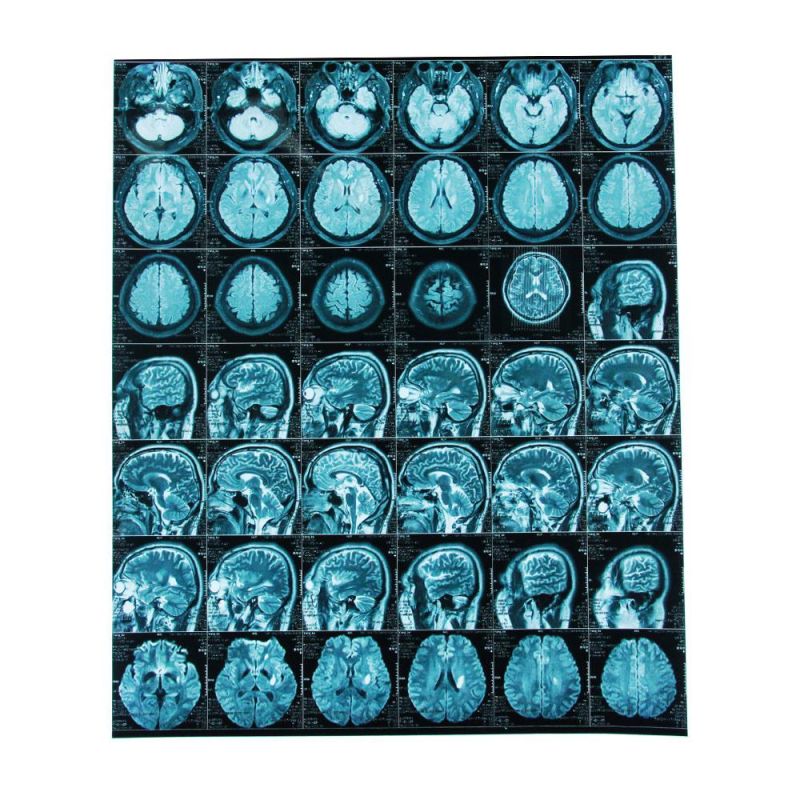 Medical Printing Radiology Universal Dry Film / 14*17 Inch Medical Blue Thermal Film/X-ray Printer