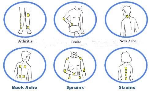 Arthritis Sprains Strain Fatigue Aches Pain Relief Relieving