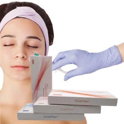 2ml Facial Sculpting Cross-Linked Dermal Filler for Facial Injection