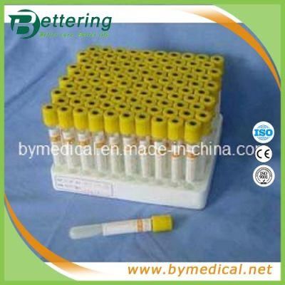 Yellow Cap Gel &amp; Clot Vacuum Blood Tubes