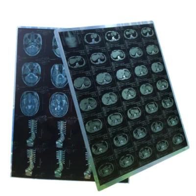 Radiology Department X-ray Blue Thermal Dry Films