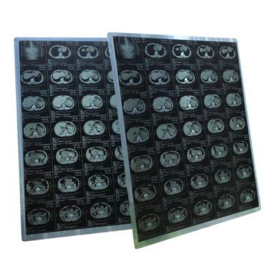 Blue and White Dry Ultrasound Films