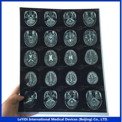20X25 Cm Blue Color Medical X-ray Film for Digital Inkjet Printer