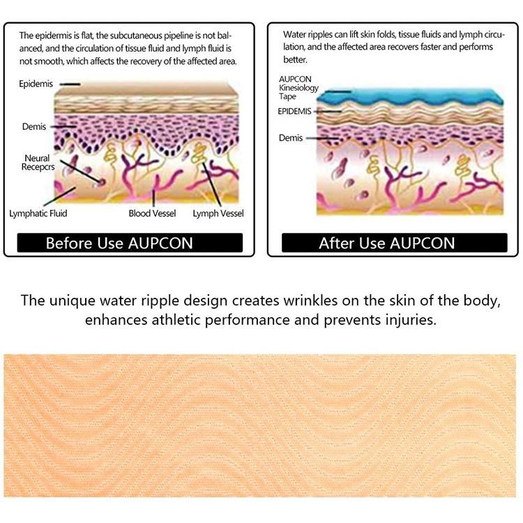 Athletic Elastic K Therapeutic Pre Cut Kinesiology Tape