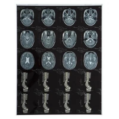 Inkjet Dry Medical X-ray Film for Fcr, CT and Cr