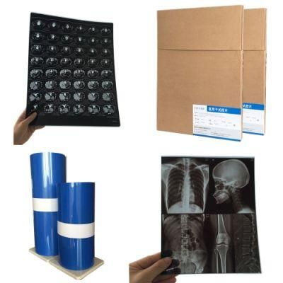 Blue Color Inkjet Dry Digital X-ray Film Price 13X17 Inch