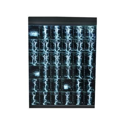 Hospital Blue X-ray Film