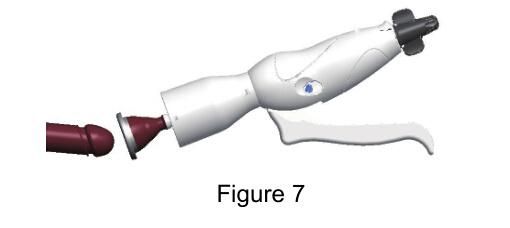 Factory Supply My-L158b Painless Disposable Foreskin Ring Cutting Stapler for Male Adult Surgical Circumcision Device