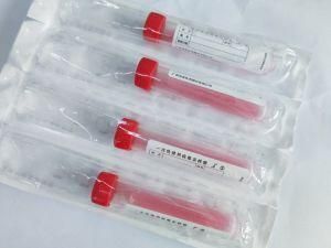 Disposable Virus Sampling Tube Kit CE/ISO/FDA/Fsc Certification