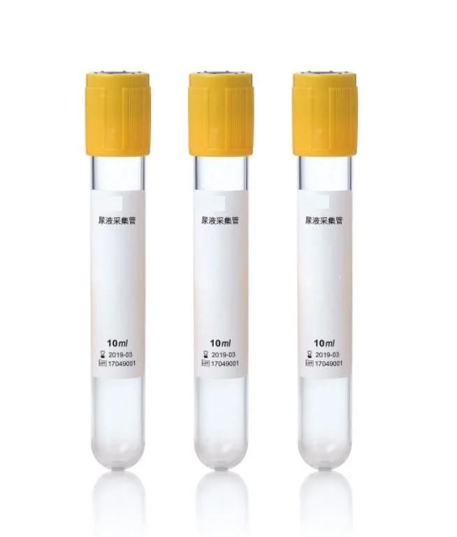 Vacuum Urine Collection Tube with Urine Container