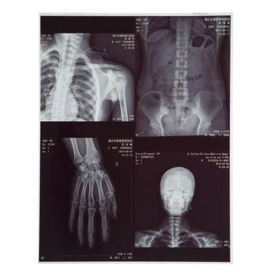 Inkjet Medical X-ray Film / Blue Film 14X 17 in