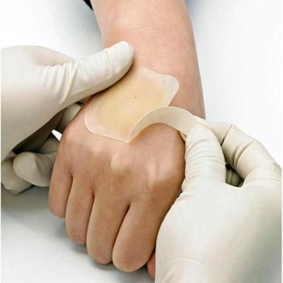 Disposable Supplies Durable Adhesive Hydrocolloid Wound Dressing