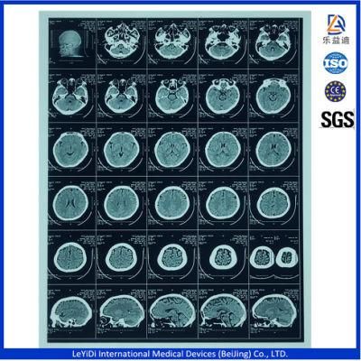 A4 and A3 Medical Blue Sensitive X-ray Films