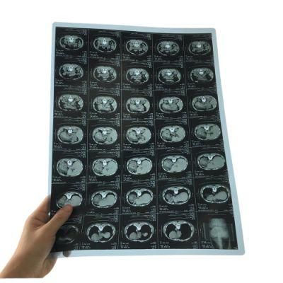 20X25 Cm Blue Color Thermal Dry X-ray Film for FUJI Drypix 2000 Film Printer