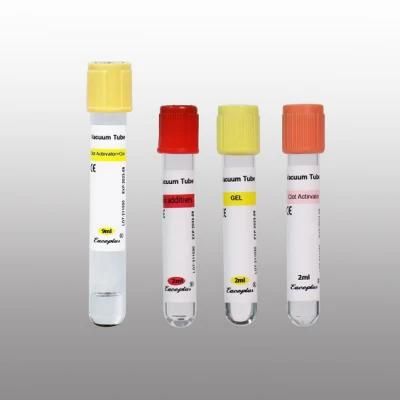 Siny Serum Vacuum Blood Collection Tubes Gel Tube 3ml 5ml with CE