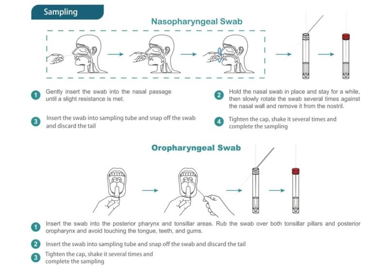 CE Medical Products Virus Antigen Rapid Diagnostic Test Kits