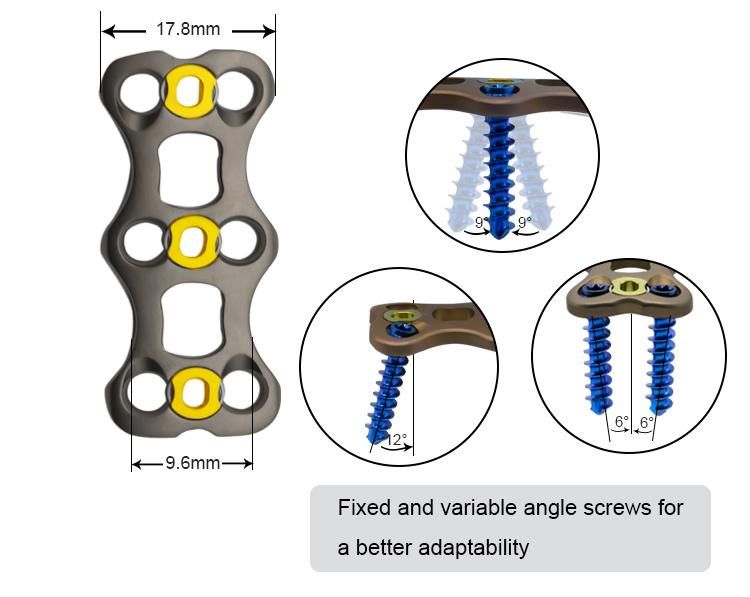 Orthopedic Implants Anterior Cervical Plate-II for Spinal Surgery