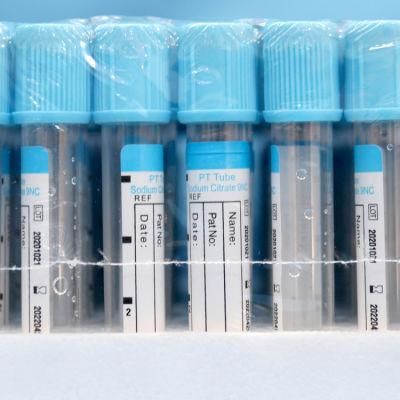 Disposable Glass or Pet EDTA/Plain/Gel&Clot/Heparin/ESR Vacuum or Non-Vacuum Blood Collection Tube