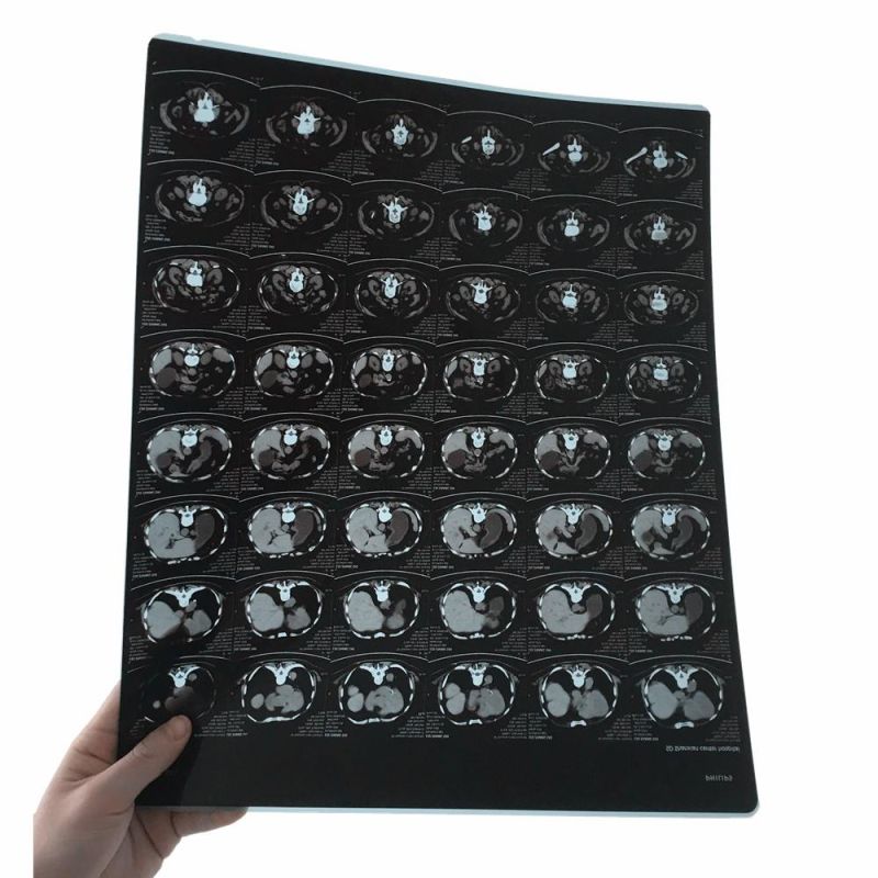 13X17 Inch Laser Blue Medical X-ray Film for FUJI Laser Printer