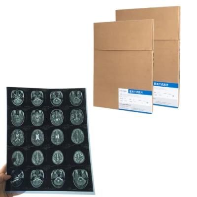 11X14 and A3 Dicom Inkjet Printing Ultrasound/Radiology Films