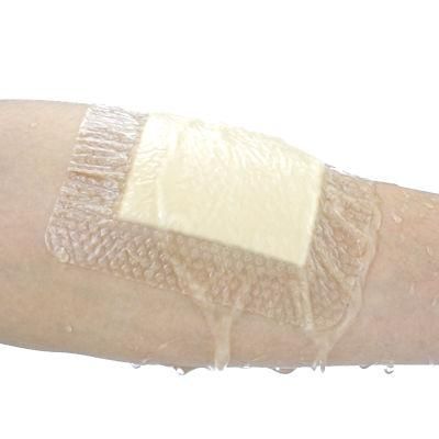 Soft Silicone Foam Dressing Sterile Hydrocolloid Foam Dressing