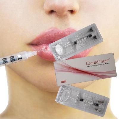 Injectable Hyaluronic Acid Filler for Lips Injection Dermal Filler