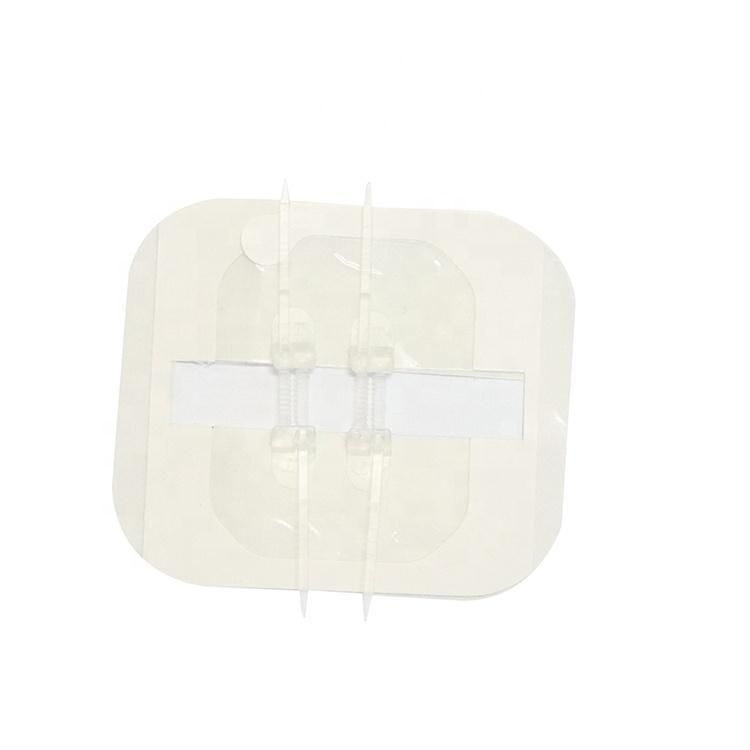 Bluenjoy Medical Grade PU Wound Closure Zipper Skin Wound Closure Device