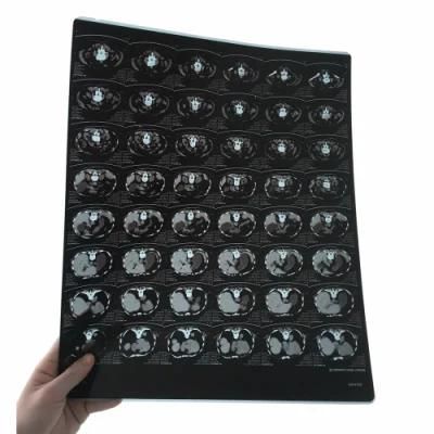 35 43cm Medical Imaging Inkjet Blue X-ray Film for CT Digital Printing