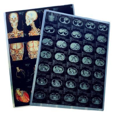 25X30 Cm Inkjet Medical X-ray Dry Digital Film for MRI Machine