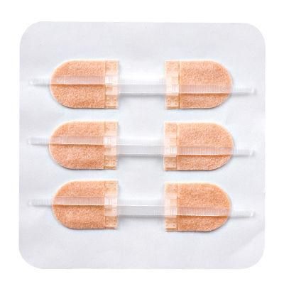 Custom High Quality Medical Suplly Zipper Type Wound Suture Patch