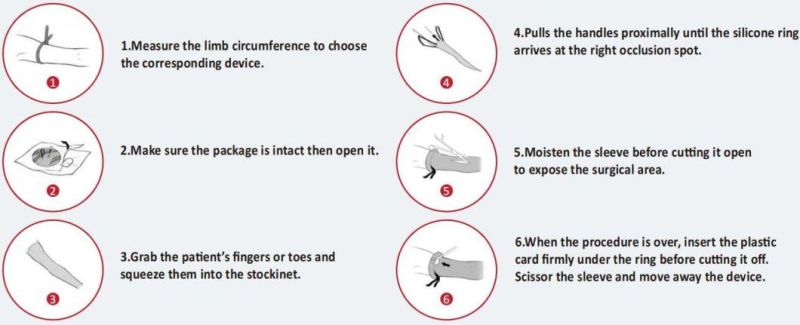 Elastic Single Use Disposable Tourniquet Ring-Shaped Exsanguination and Occlusion Surgical Device Medical Equipment for Limb Procedures Emergency Aid