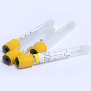 Low Price Medical Sterile Pet/Glass Vacuum Bd Bblood Collection Serum Tube