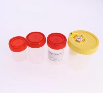 Disposable Urine Cup Vacuum Urine Specimen Container Cup