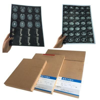 A4 8X10 Laser Blue X-ray Medical Film for Canon Epson Printer