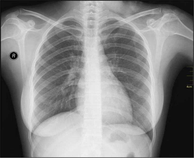 Low Price Color Printing Medical X-ray Film