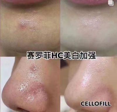 Cellofill Chanel Cerofi Anti-Oxidation, Promote Skin Tissue Reorganization and Repair Skin Booster Products Scm Dermal Filler