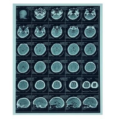 Medical Radiology Professionals Laser Images Film