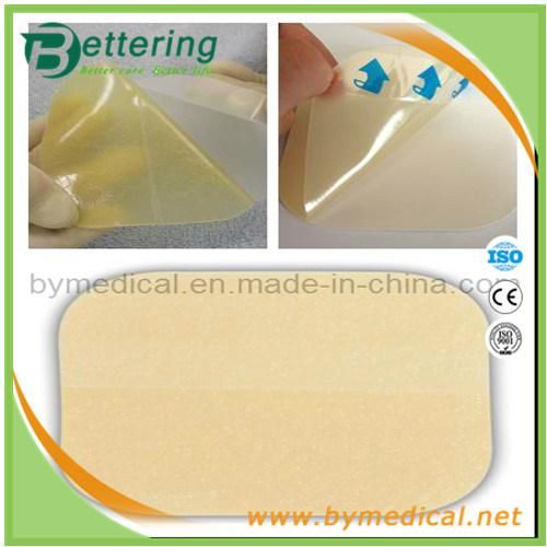 Medical Adhesive Hydrocolloid Wound Dressing