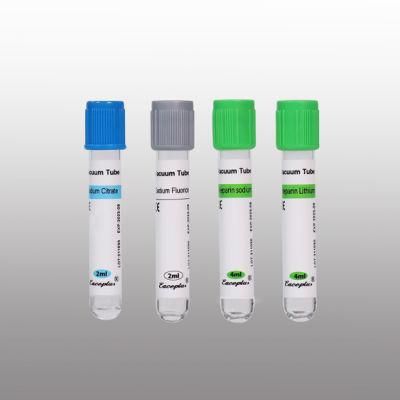 Siny Sst Disposable Vacuum Blood Collection Tube with Sodium Citrate