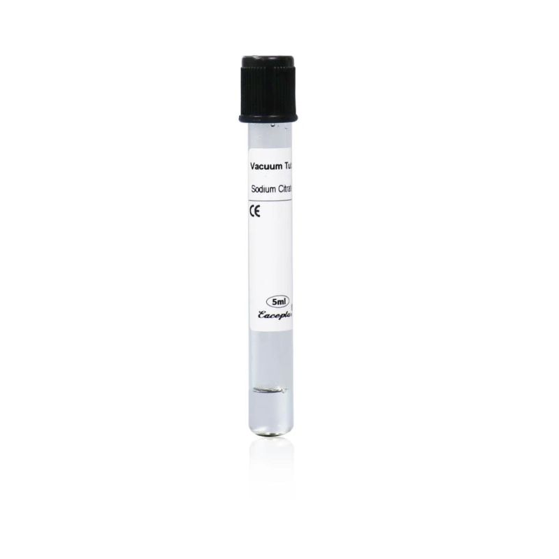 Siny Disposable Medical Supplies ESR Test 3.8% Sodium Citrate Vacuum Blood Collection Test Tube with CE