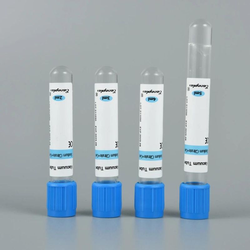 Siny Blood Collection Tube Gel&Sodium Citrate Tube Blue Cap with CE ISO 13458-2.7ml