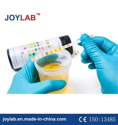 in Vitro Diagnostic Disposable Urine Strips