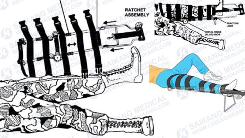 Leg Traction Device, Leg Traction Splints
