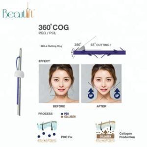 Best Price Absorbable Monofilament Pdo Thread Lift for Face Body