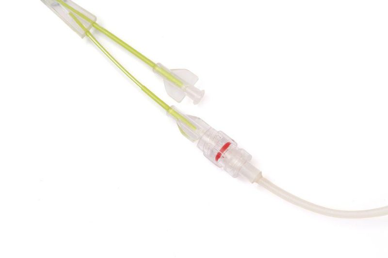 Ureteral Balloon Dilatation Catheter Solve The Urinary Obstruction with CE Certificate
